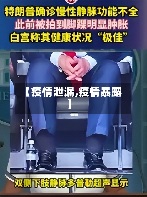 【疫情泄漏,疫情暴露】-第1张图片