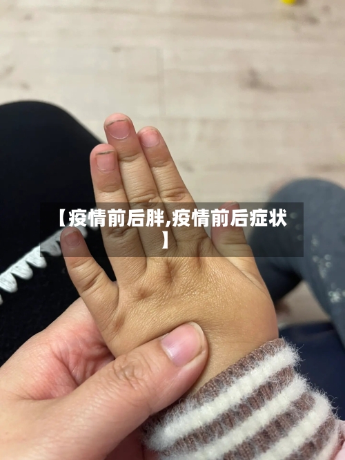 【疫情前后胖,疫情前后症状】-第2张图片