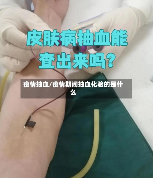 疫情抽血/疫情期间抽血化验的是什么-第2张图片