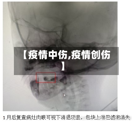 【疫情中伤,疫情创伤】-第2张图片