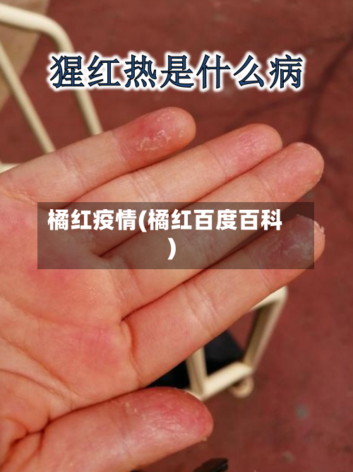 橘红疫情(橘红百度百科)-第1张图片