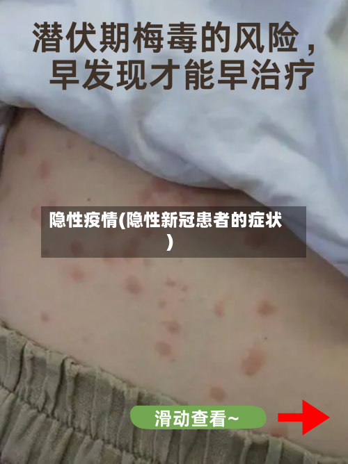 隐性疫情(隐性新冠患者的症状)-第1张图片