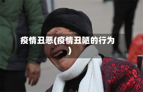 疫情丑恶(疫情丑陋的行为)-第1张图片