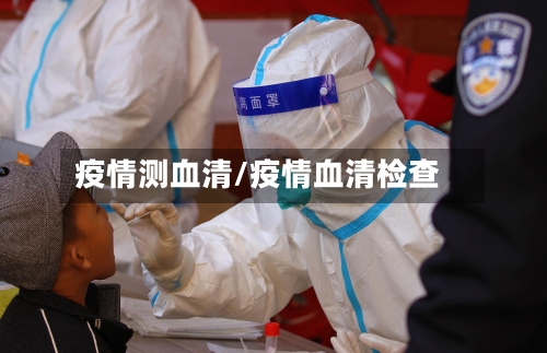 疫情测血清/疫情血清检查-第1张图片